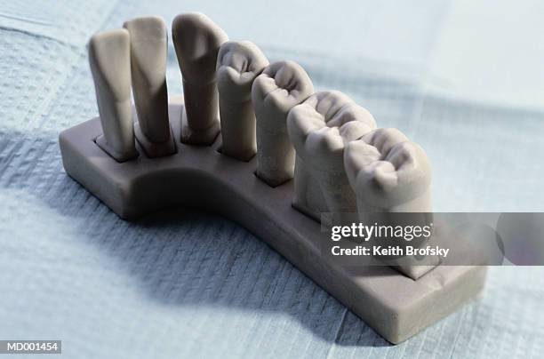 plaster teeth - dental mould stock pictures, royalty-free photos & images