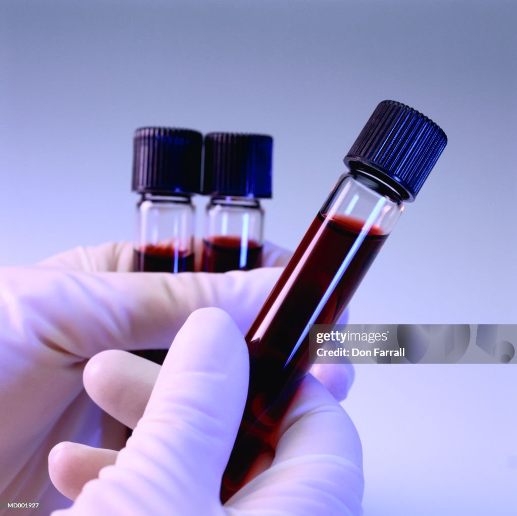 Blood Samples