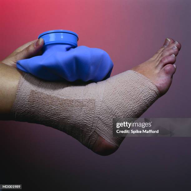 elastic support bandage and ice pack on ankle - elastic bandage stock pictures, royalty-free photos & images