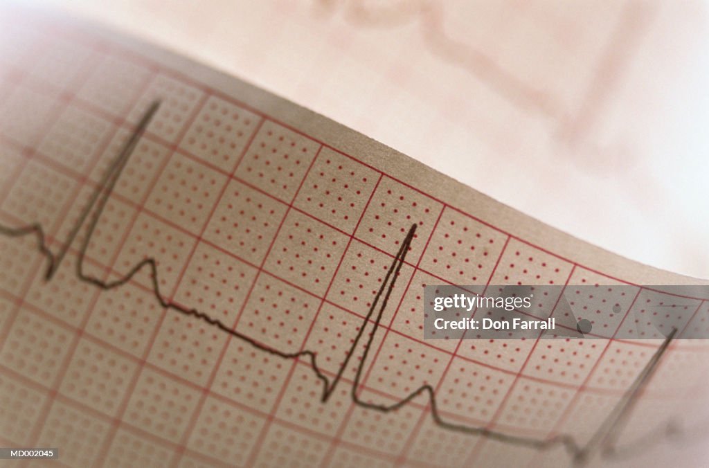 EKG Printout