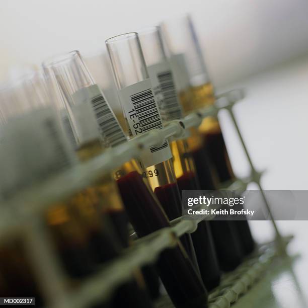 blood samples in test tubes - test tube rack stock pictures, royalty-free photos & images