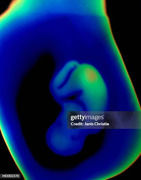 thermal image of embryo - christie stock pictures, royalty-free photos & images