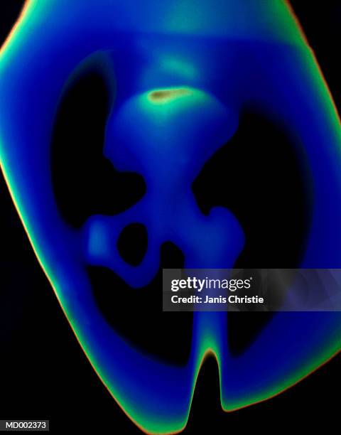 thermal image of hip bone - christie stock pictures, royalty-free photos & images