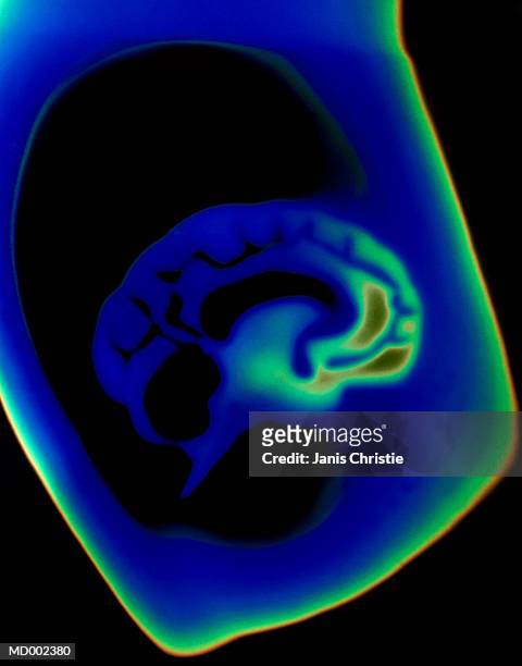 thermal image of human brain - christie stock pictures, royalty-free photos & images
