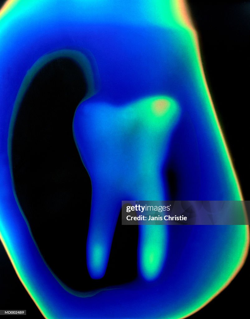 Thermal Image of Tooth