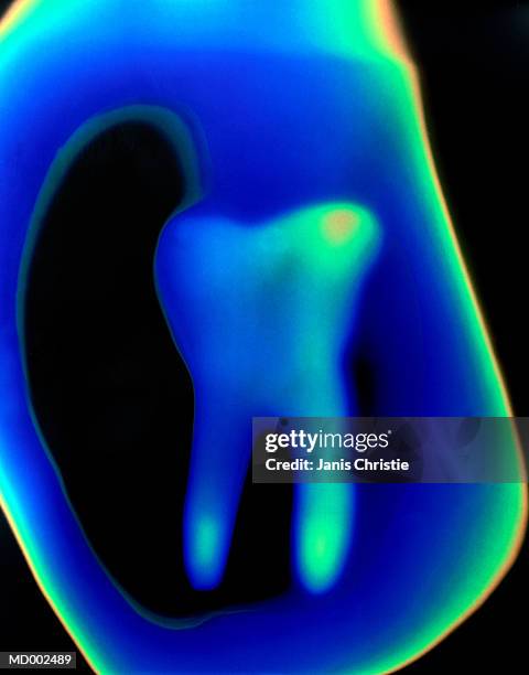 thermal image of tooth - christie stock pictures, royalty-free photos & images