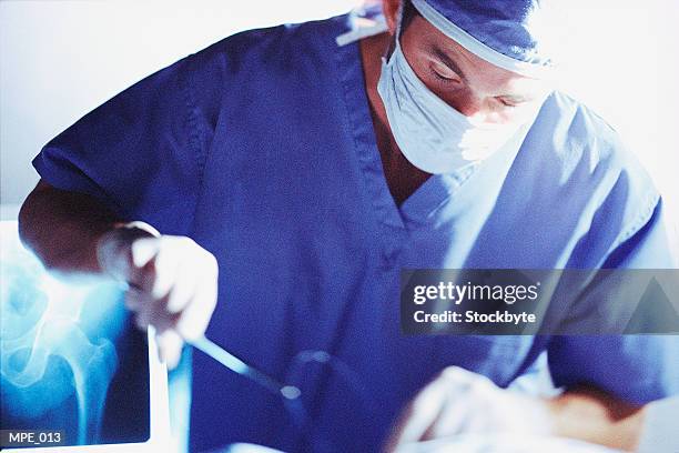 surgeon tying suture - hecht stockfoto's en -beelden