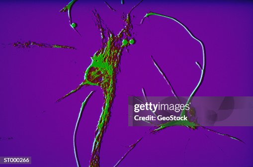 Micro-Neuron Micro-Neuron