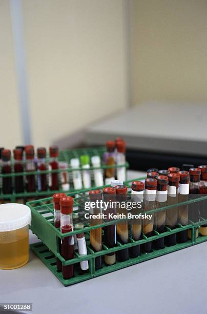 vials - reageerbuisrek stockfoto's en -beelden