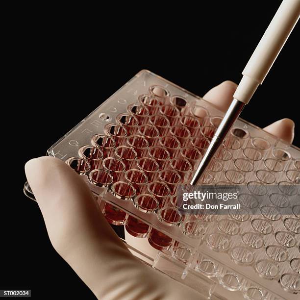 filling tray with blood samples - don farrall stock pictures, royalty-free photos & images