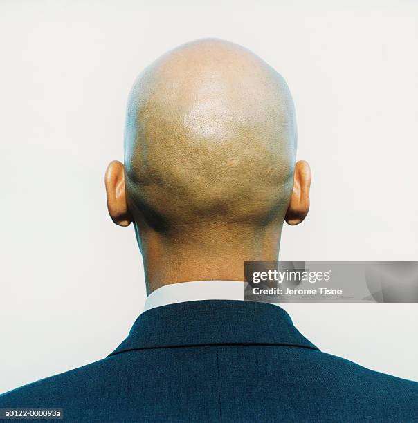 back of businessman's head - hair loss imagens e fotografias de stock