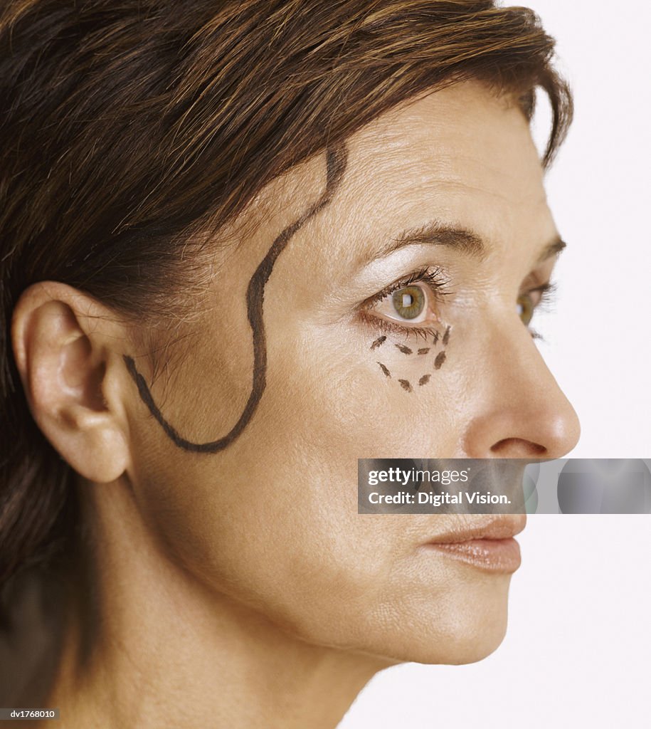 Portrait of a Woman with Markings on Her Face in Preparation for Cosmetic Surgery