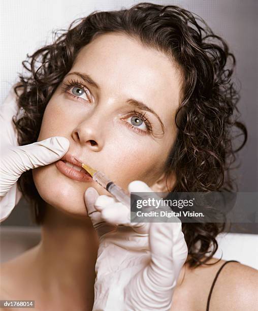 young woman receiving a collagen injection to her upper lip - anatomical substance foto e immagini stock