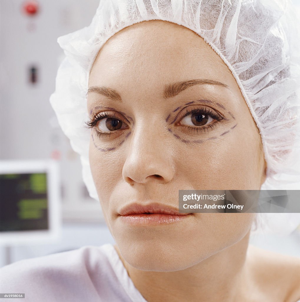 Woman With Cosmetic Surgery Pen Marks Around Her Eyes