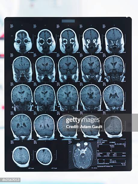 x ray of a human skull - adam ray stock pictures, royalty-free photos & images