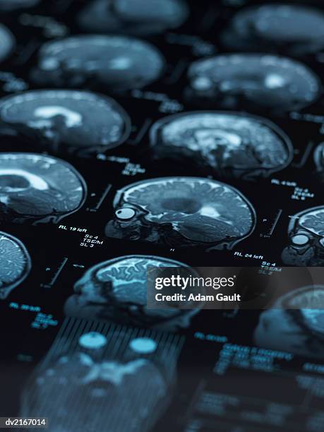 x ray of a human skull - adam ray stock pictures, royalty-free photos & images