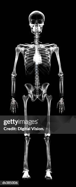 Skeleton High-Res Stock Photo