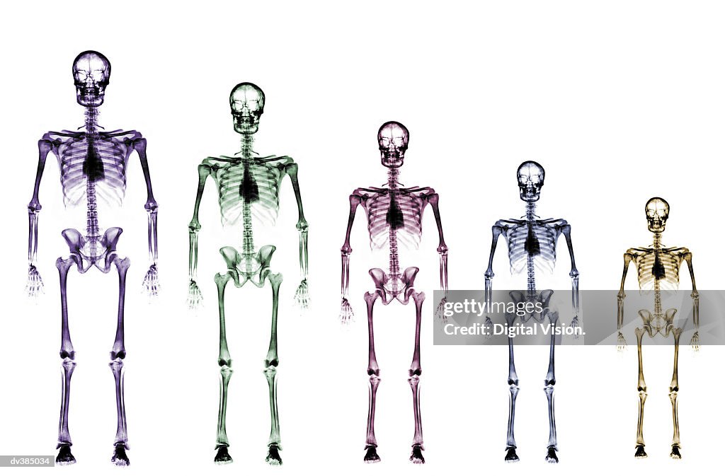 Skeleton growth chart