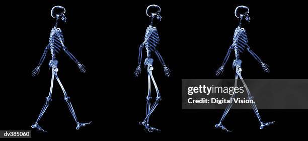 series of walking skeletons - x ray human stock pictures, royalty-free photos & images