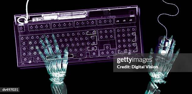 using computer - skelett hand stock-fotos und bilder