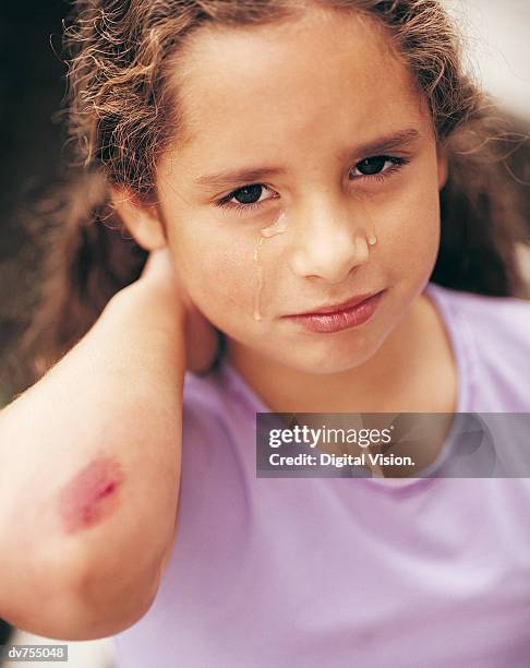 portrait of a girl with a graze on her elbow - hinge joint stock pictures, royalty-free photos & images