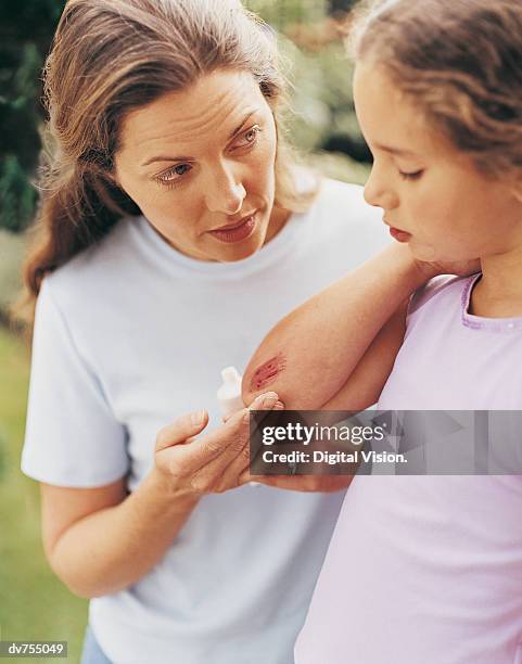 mother applying antiseptic to daughter's injured elbow - hinge joint stock pictures, royalty-free photos & images