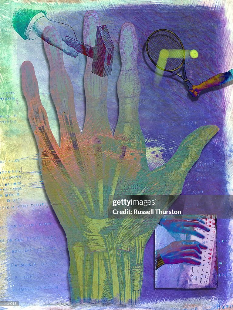 Carpal Tunnel System