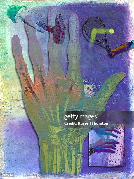 Carpal Tunnel System, 照片檔