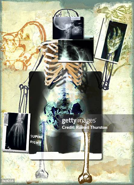 x-ray montage - montage stock illustrations