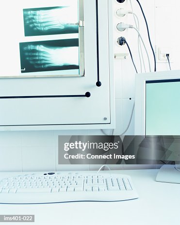 X-rays and computer X-rays and computer