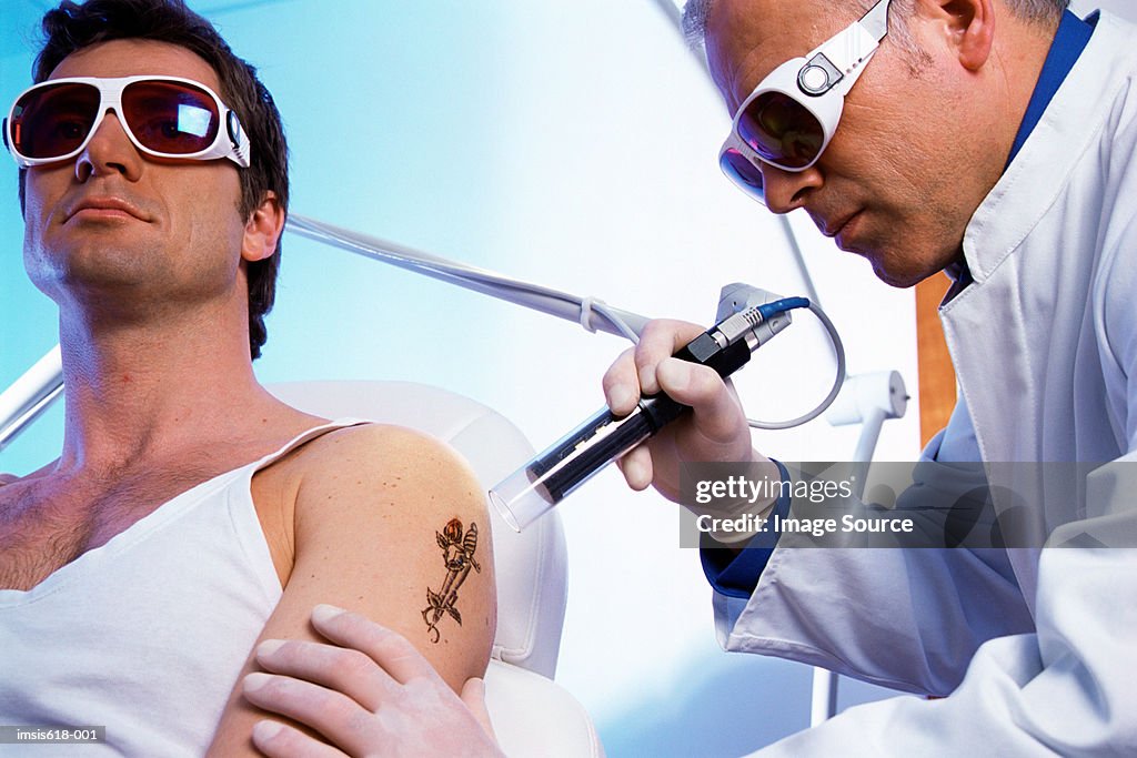 Man having tattoo removed