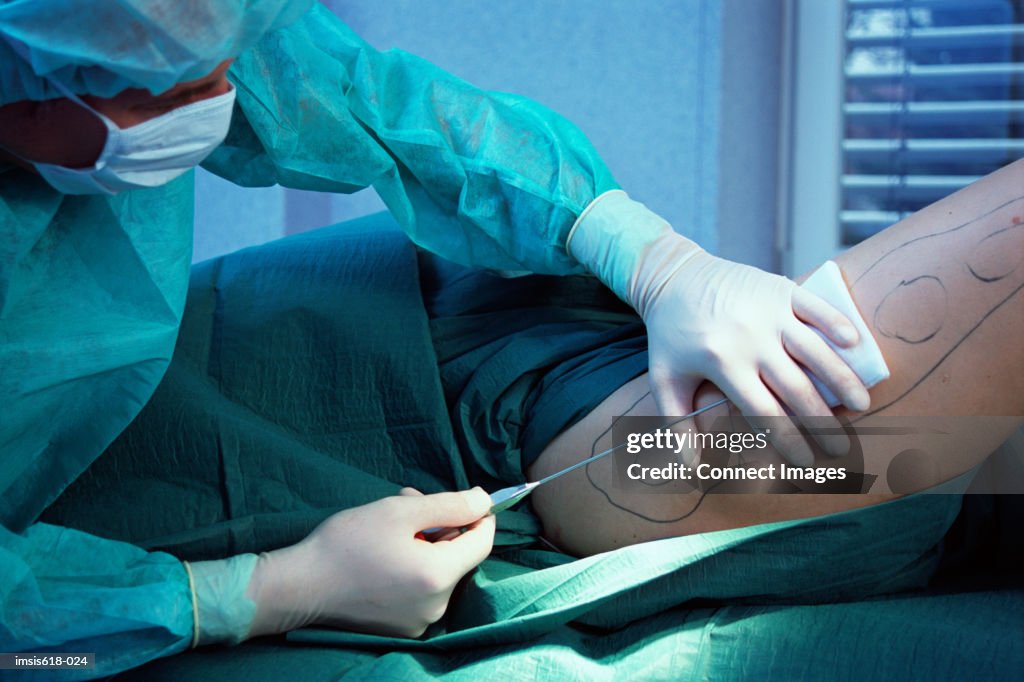 Woman having liposuction