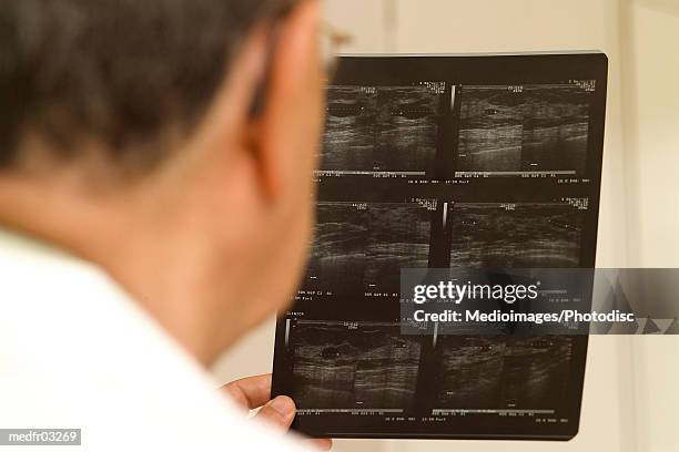 doctor reading an x-ray film - gifted film ストックフォトと画像
