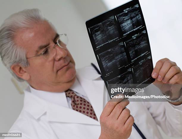 an elderly male doctor looking at an x-ray film - gifted film ストックフォトと画像