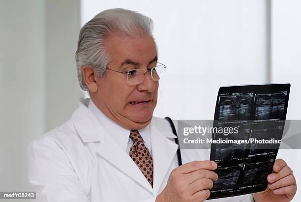 male doctor looking at an x-ray film - gifted film ストックフォトと画像