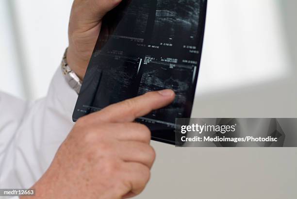doctor examining an x-ray film - gifted film ストックフォトと画像