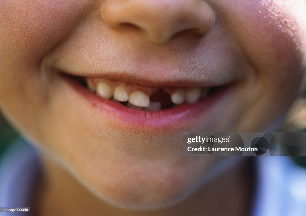 Gap-toothed smile