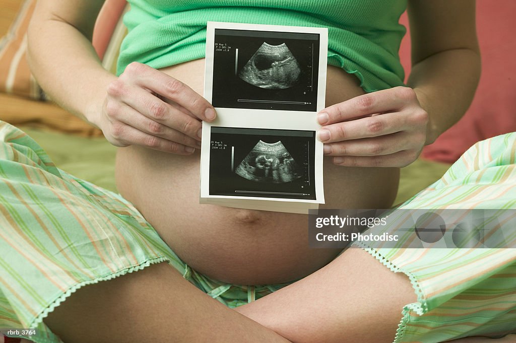 Mid section view of a young pregnant woman showing an ultrasound