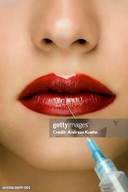 young woman receiving injection in lip, close-up - woman injecting stock pictures, royalty-free photos & images