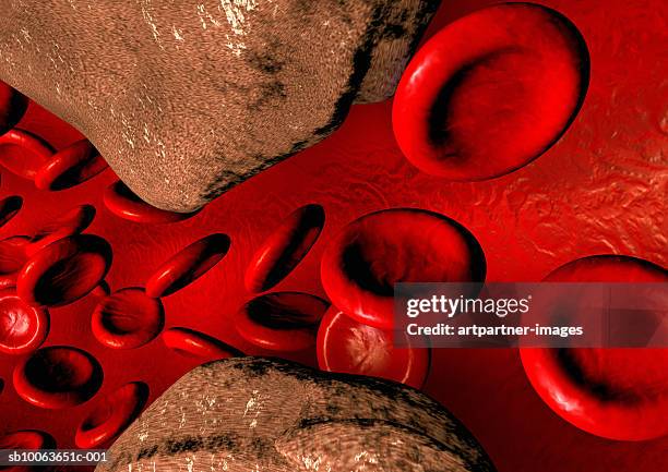 illustrazioni stock, clip art, cartoni animati e icone di tendenza di blood vessel with arteriosclerosis - blood