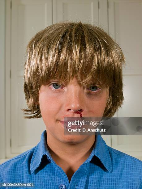 boy (9-11) with bruises and bloody nose, portrait, close-up - bad bangs stock pictures, royalty-free photos & images