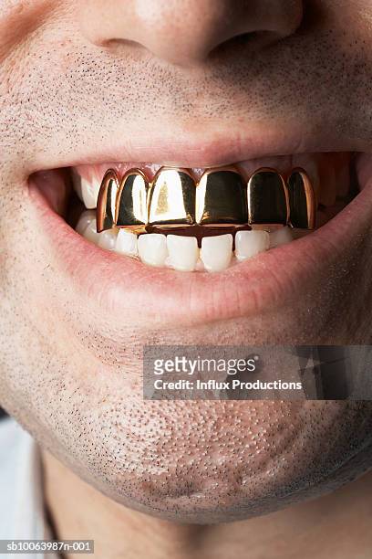 man with gold front teeth, close-up of mouth - capped tooth stock-fotos und bilder
