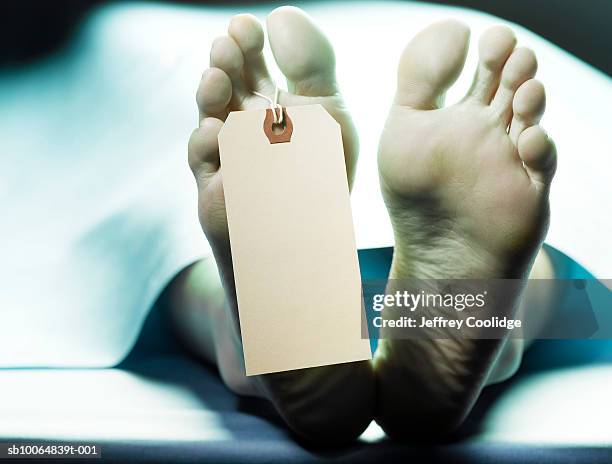 dead person on autopsy table with name tag on toe, low section - cadáver fotografías e imágenes de stock
