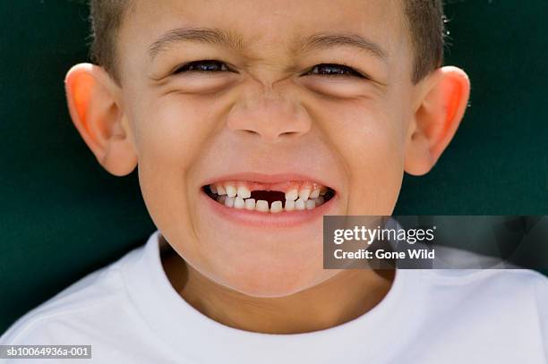 grinning young boy (6-7) with front teeth missing, portrait, close-up - tothless boys stock-fotos und bilder