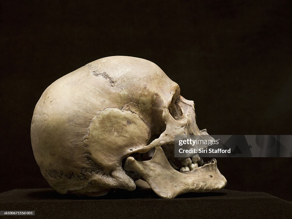 Human skull, side view, studio shot