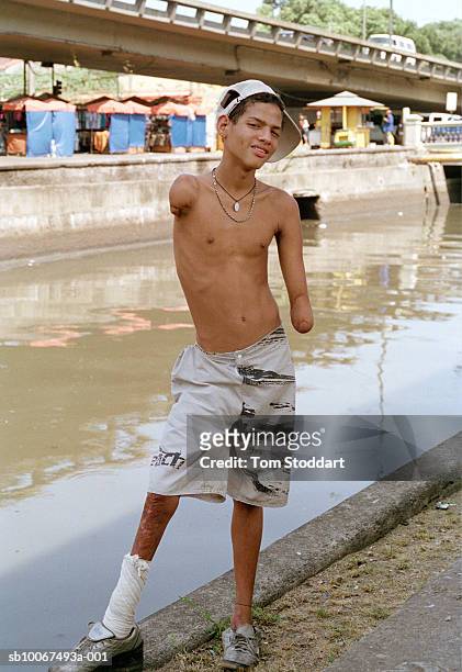 Pictured is Sergio who lost his arms while jumping trains in downtown Rio. He lives alongside a canal with other street children near the city bus...