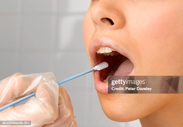 person holding dna swab in young woman's mouth, close up of mouth, studio shot - amostra médica imagens e fotografias de stock