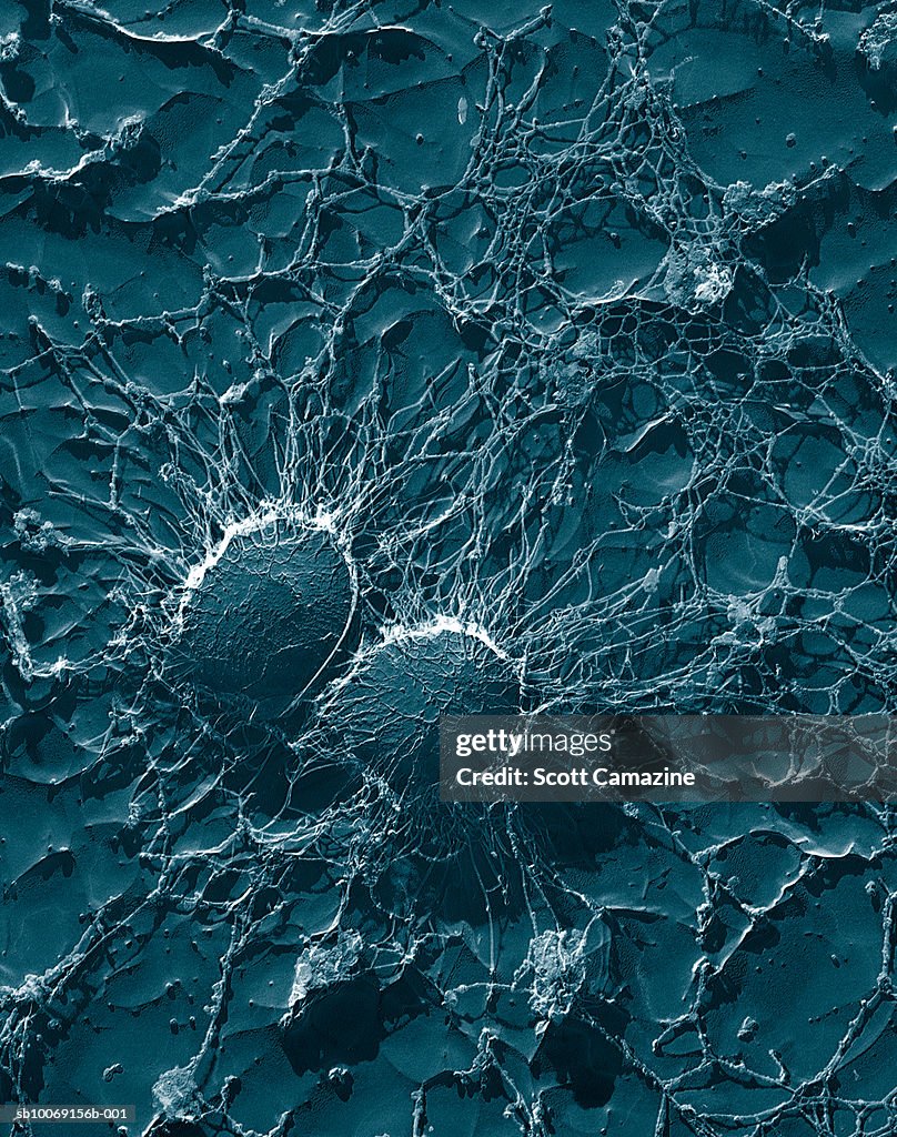 Micrograph of bacterial cells of Staphylococcus aureus