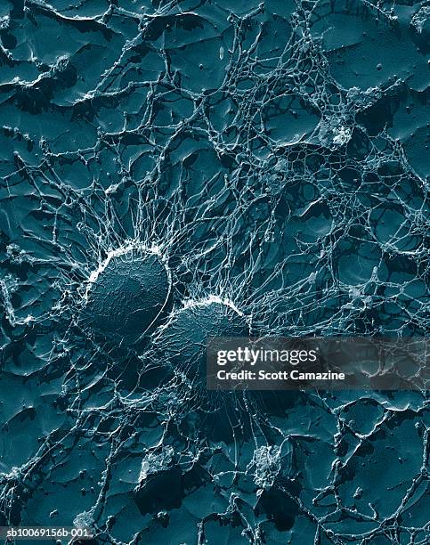 micrograph of bacterial cells of staphylococcus aureus - staphylococcus stock pictures, royalty-free photos & images