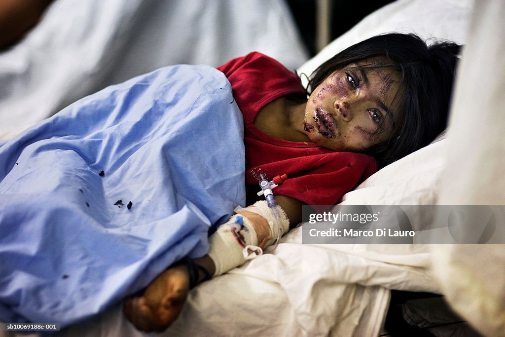 Bruised and wounded girl (8-9) lying in hospital bed